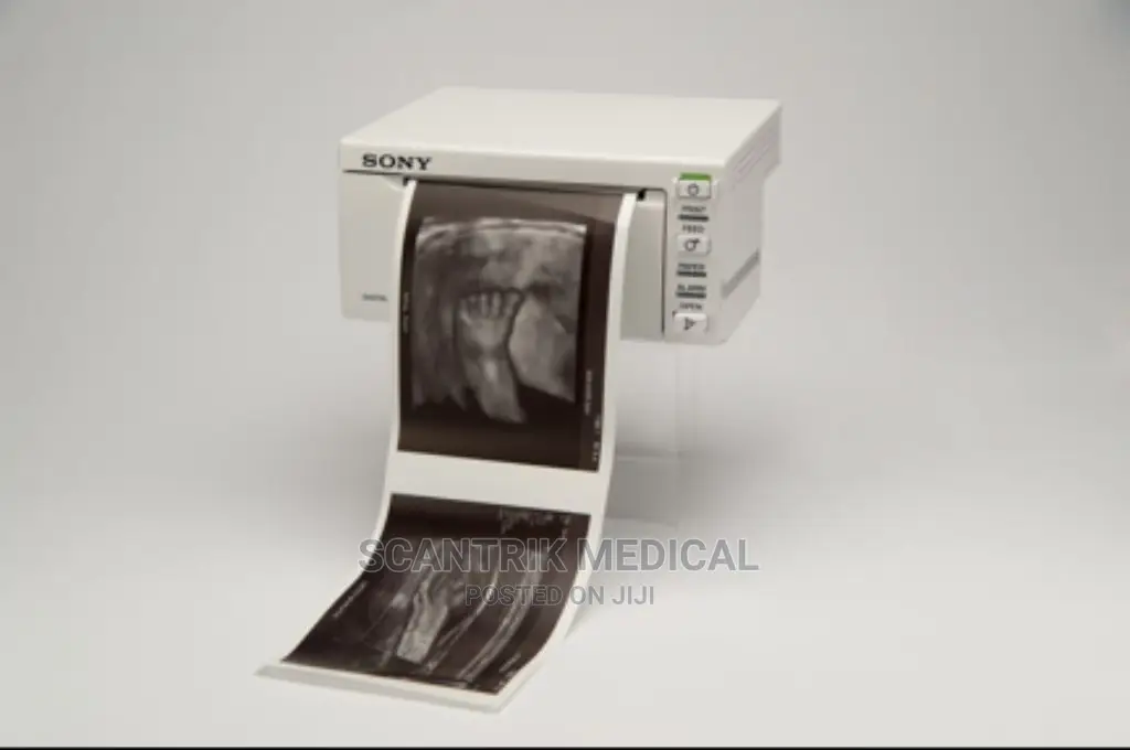 Ultrasound Printer Paper