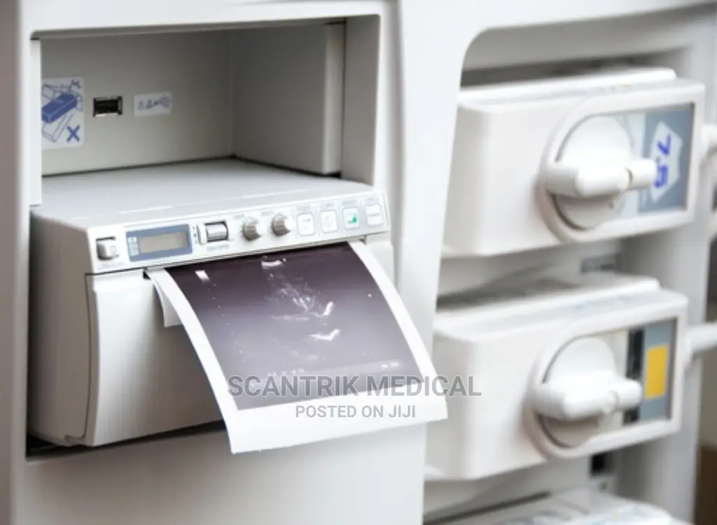 Ultrasound Machine Printer