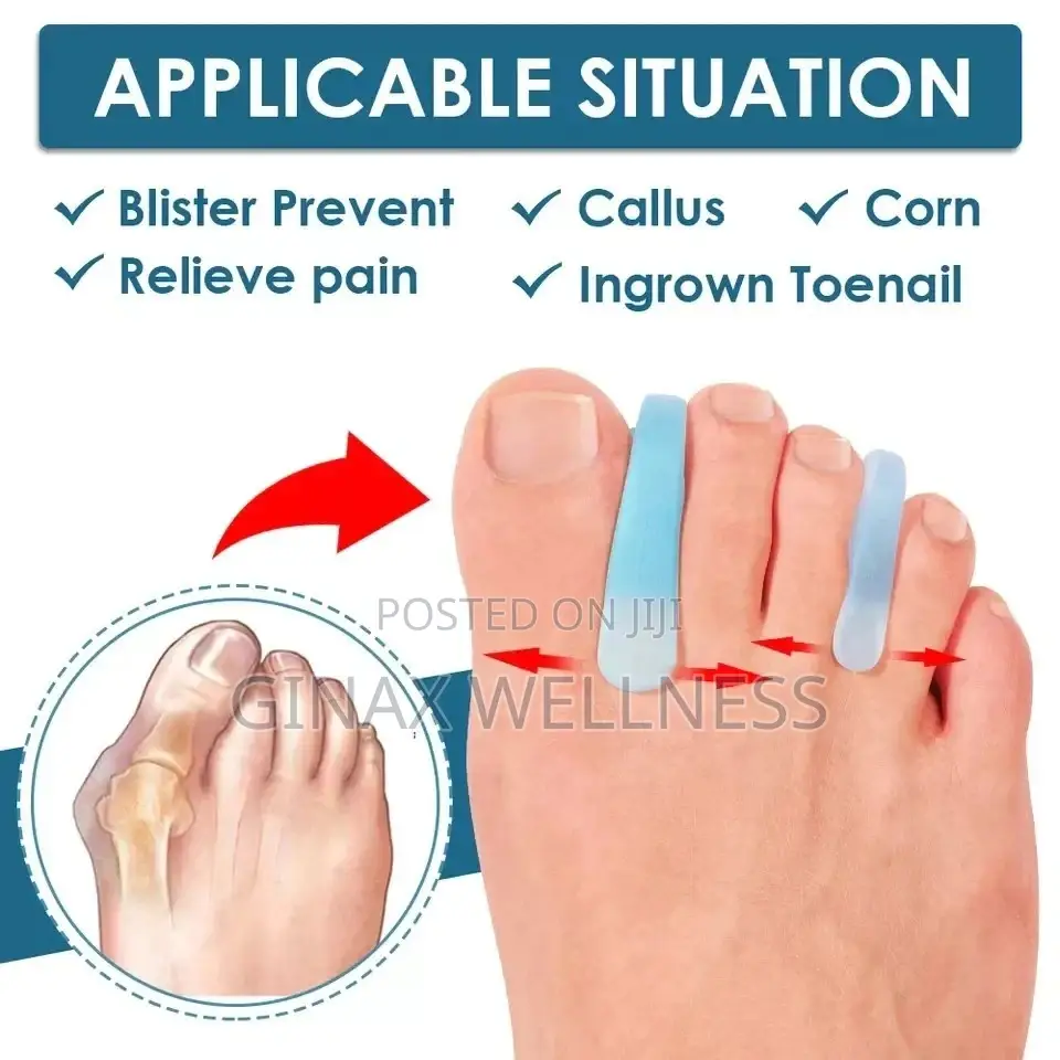 A Line Silicone Toe Seperator 4 Bunion, Overlapping Toes