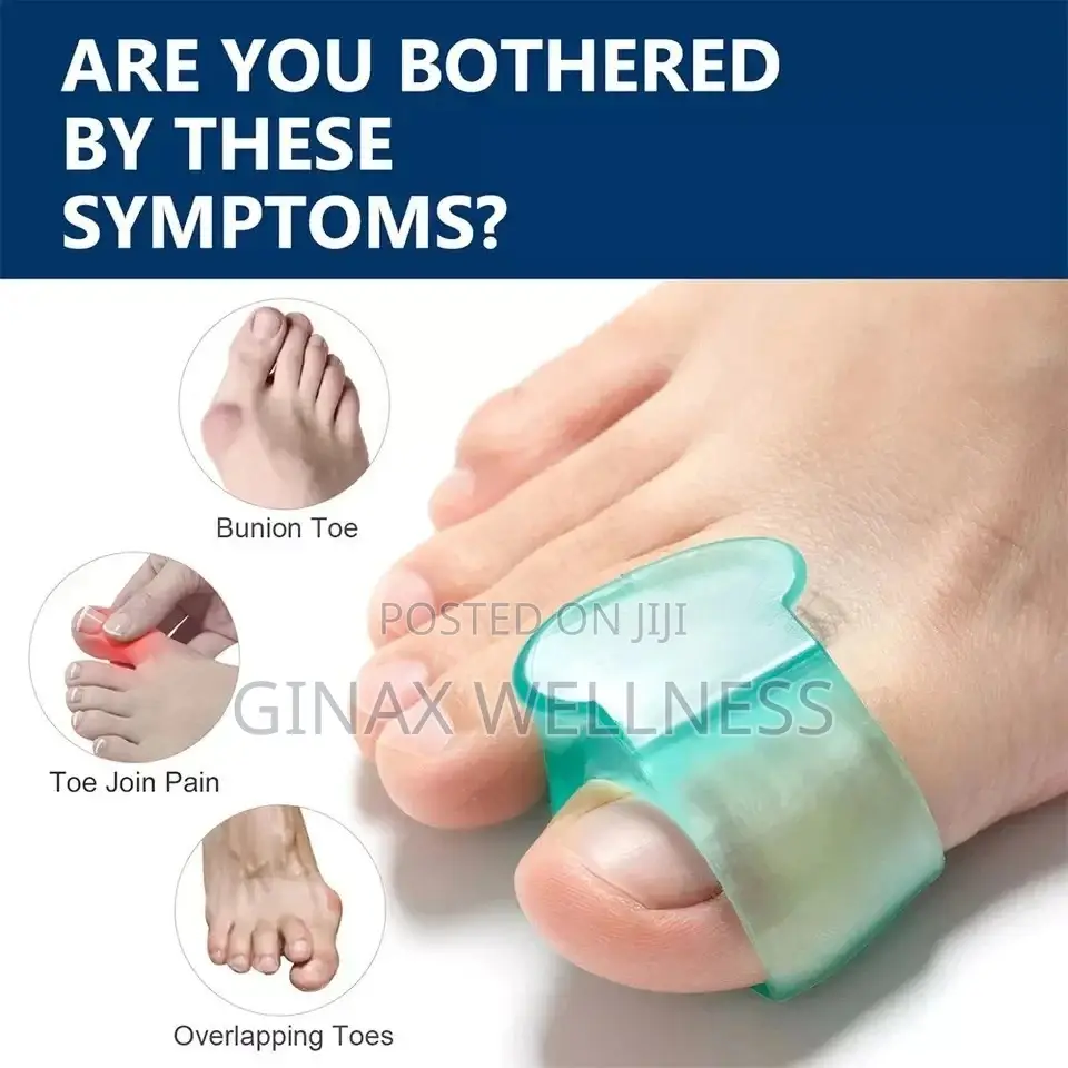 A-Line Silicone Toe Separator | Ortho Corrector for Bunion