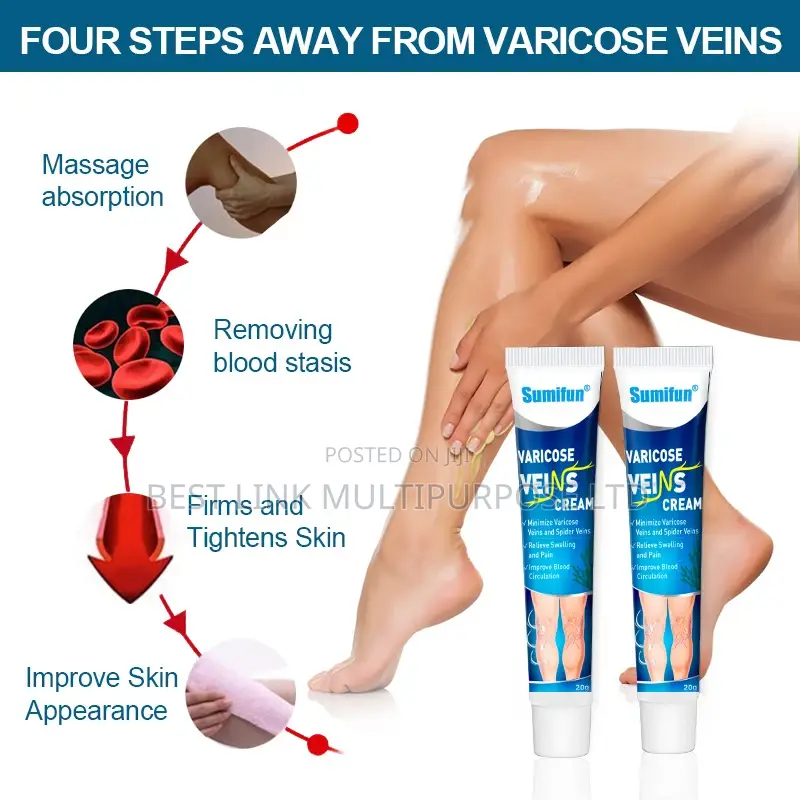 Varicose Veins Cream(Wholesale Deal)