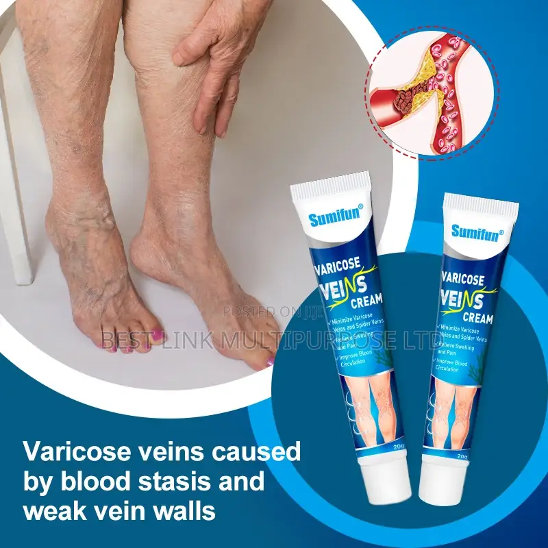 Varicose Veins Cream(Wholesale Deal)