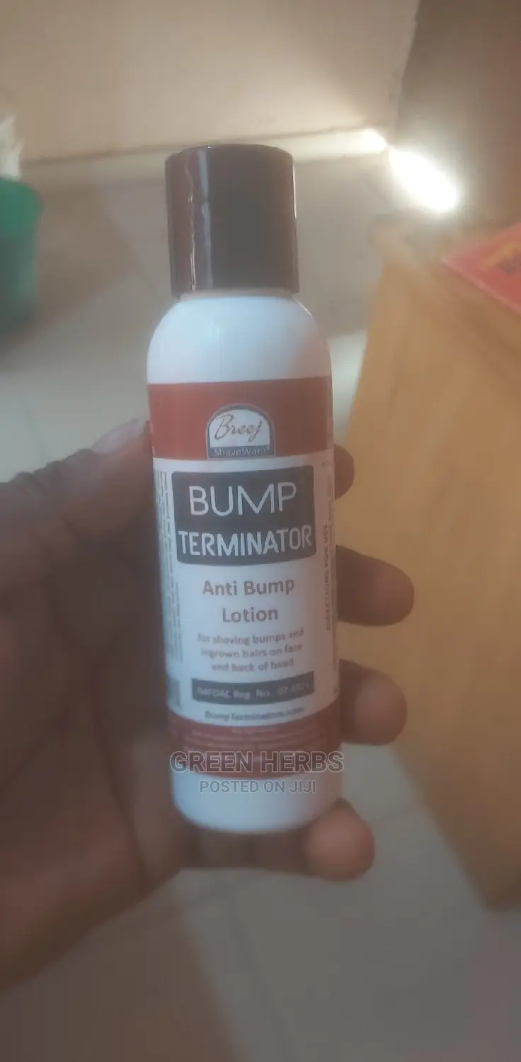 Bump Terminator Lotion (For Back-Head Bump)