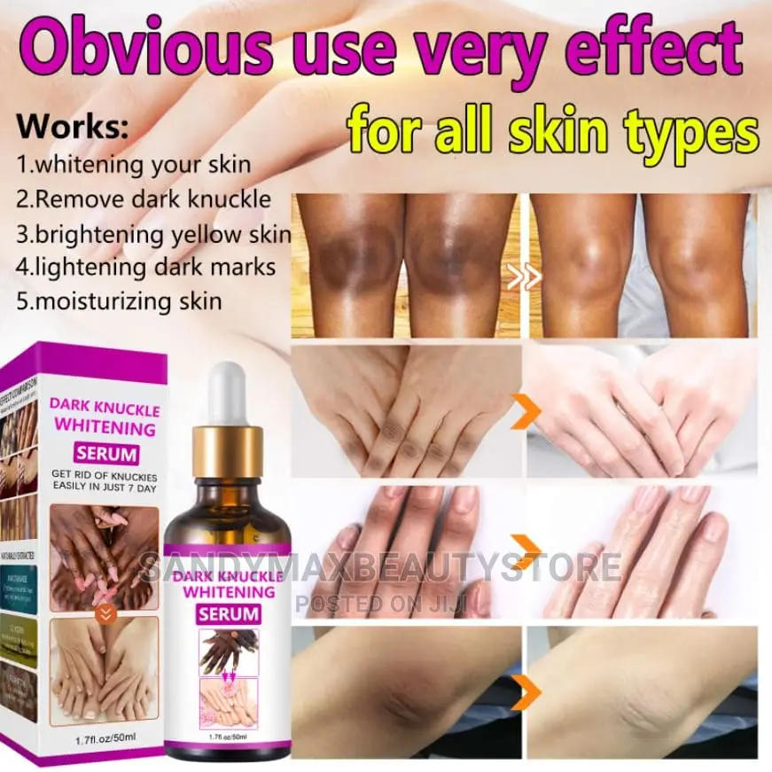 Dark Knuckle Whitening Serum
