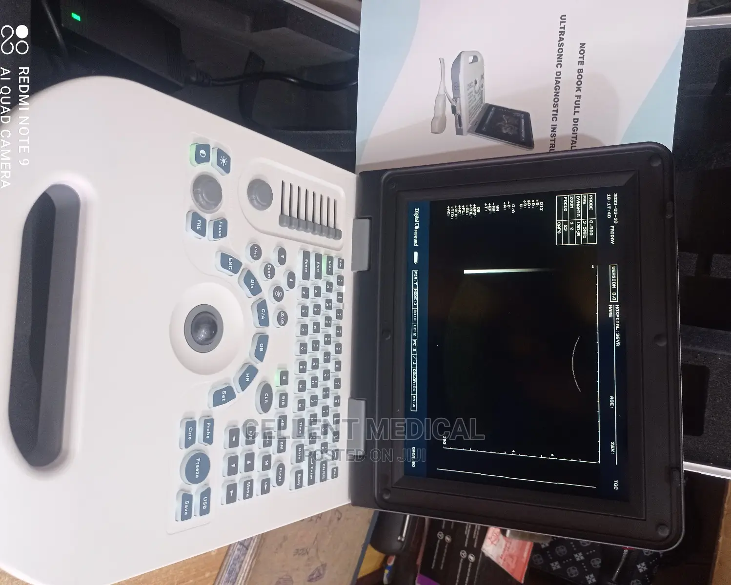 Laptop Ultrasound Machine