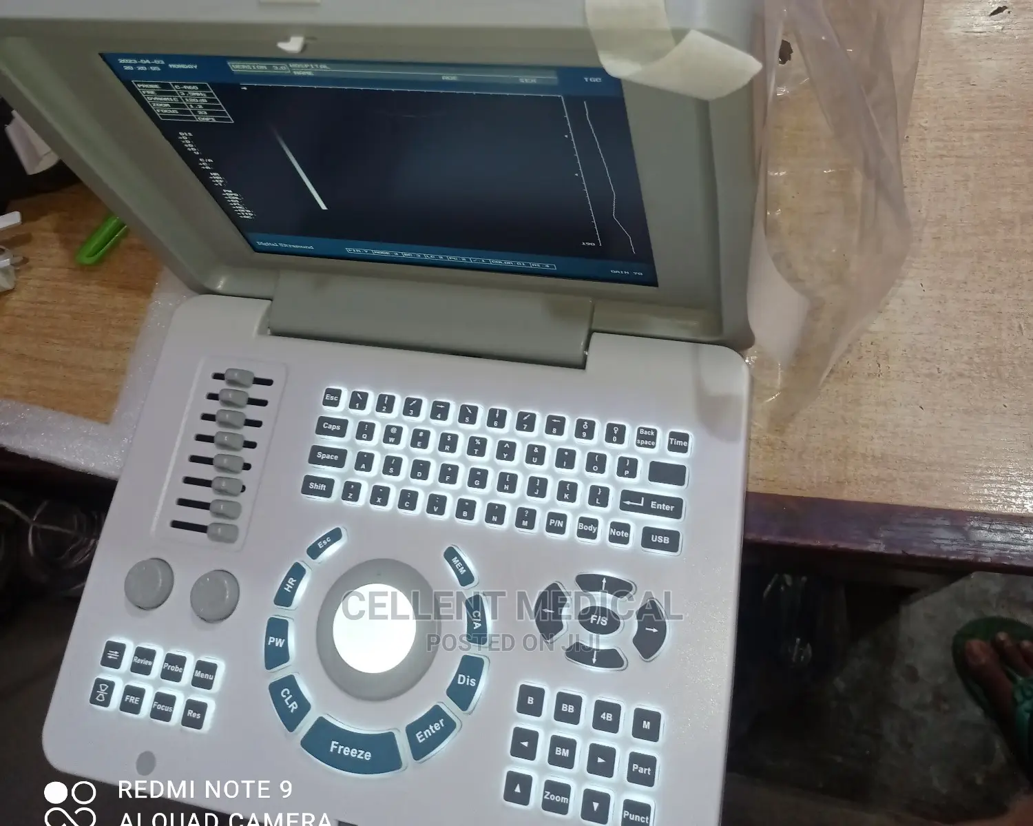 Ultrasound Scanning Machine