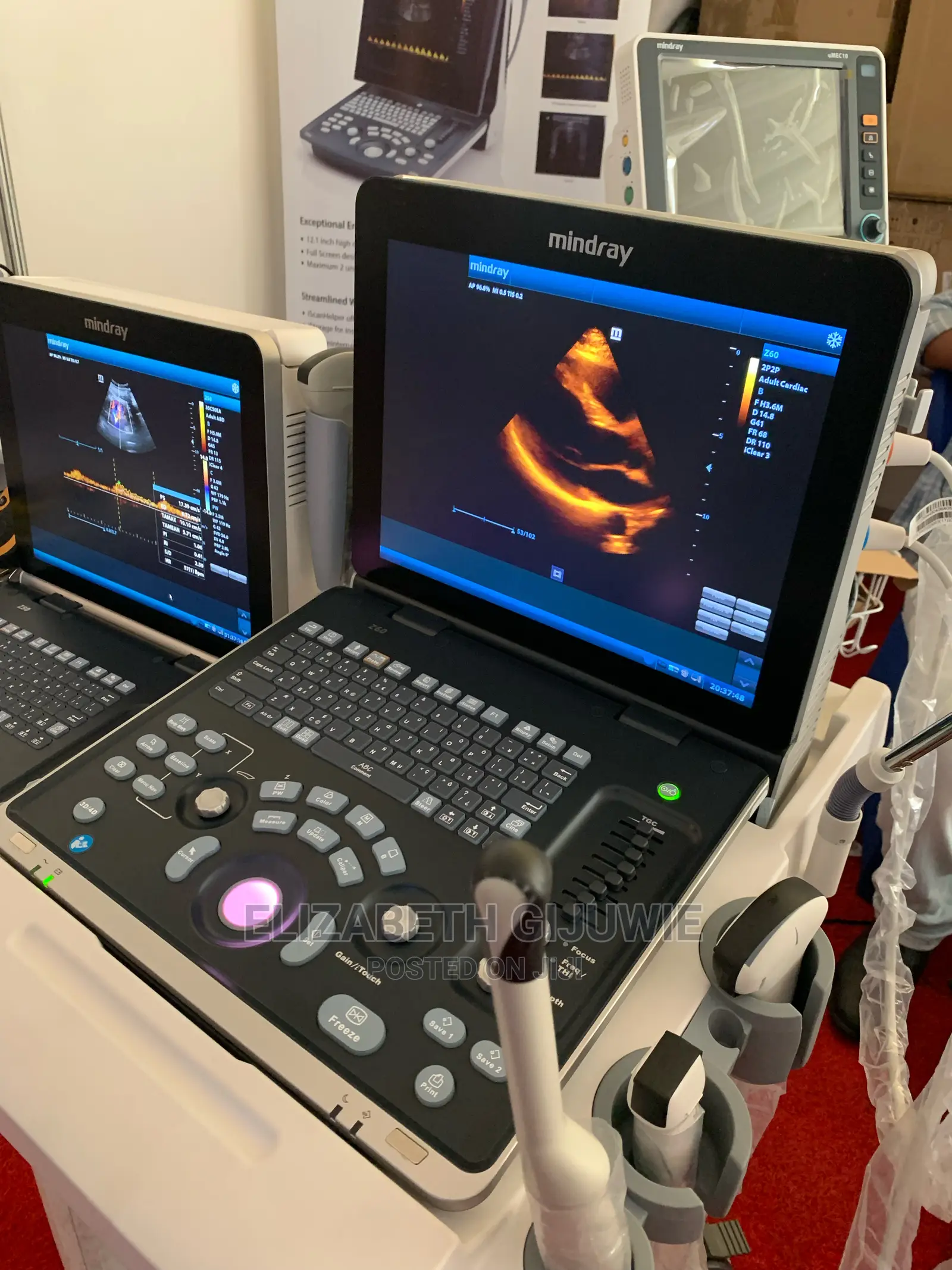 Mindray Z60 Ultrasound Machine