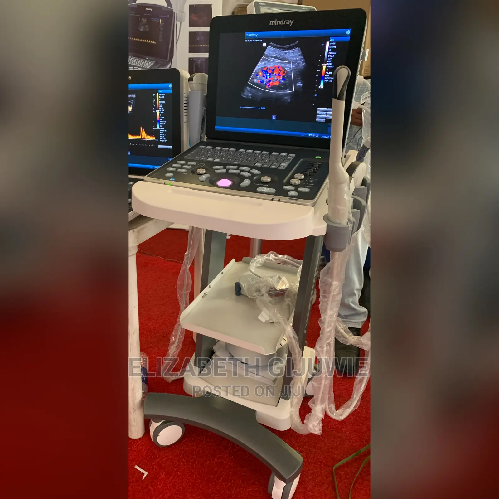 Mindray Z60 Ultrasound Machine