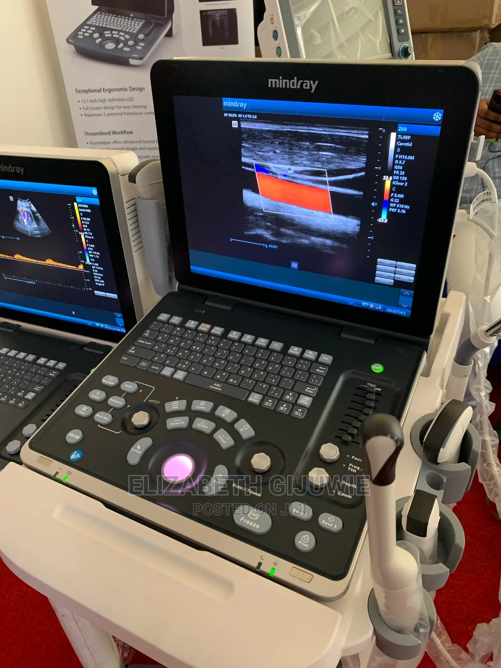 Mindray Z60 Ultrasound Machine