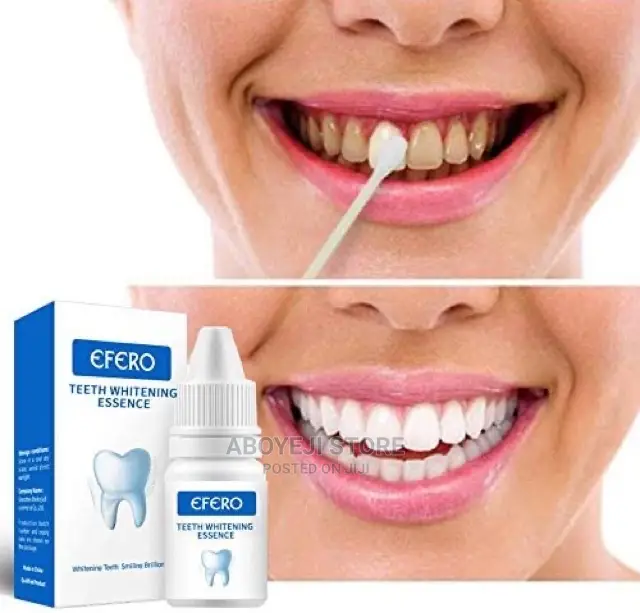 EFERO Teeth Whitening