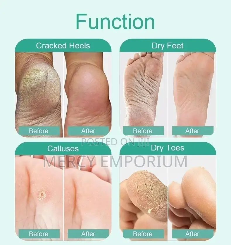 Exfoliating Foot Mask for Dead Foot Skin Manicure Cracked Heels Care
