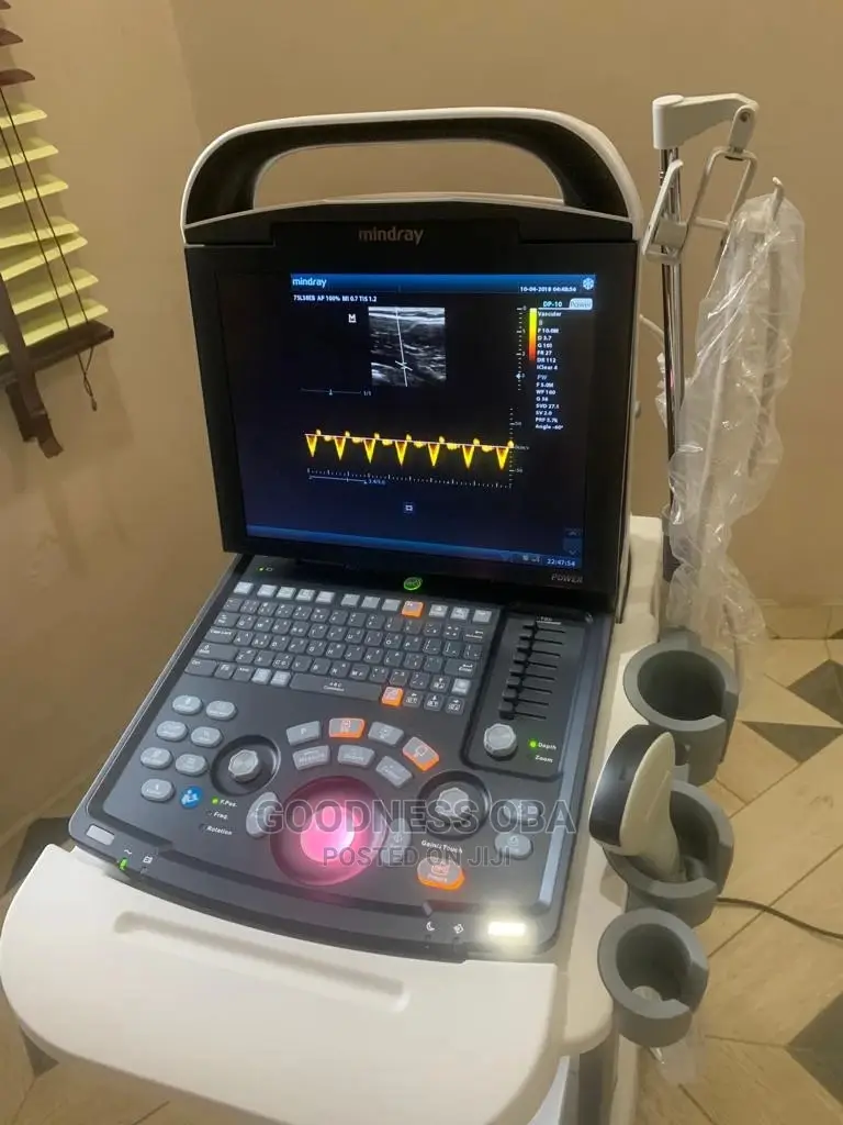 Mindray Dp 10 Ultrasound Machine