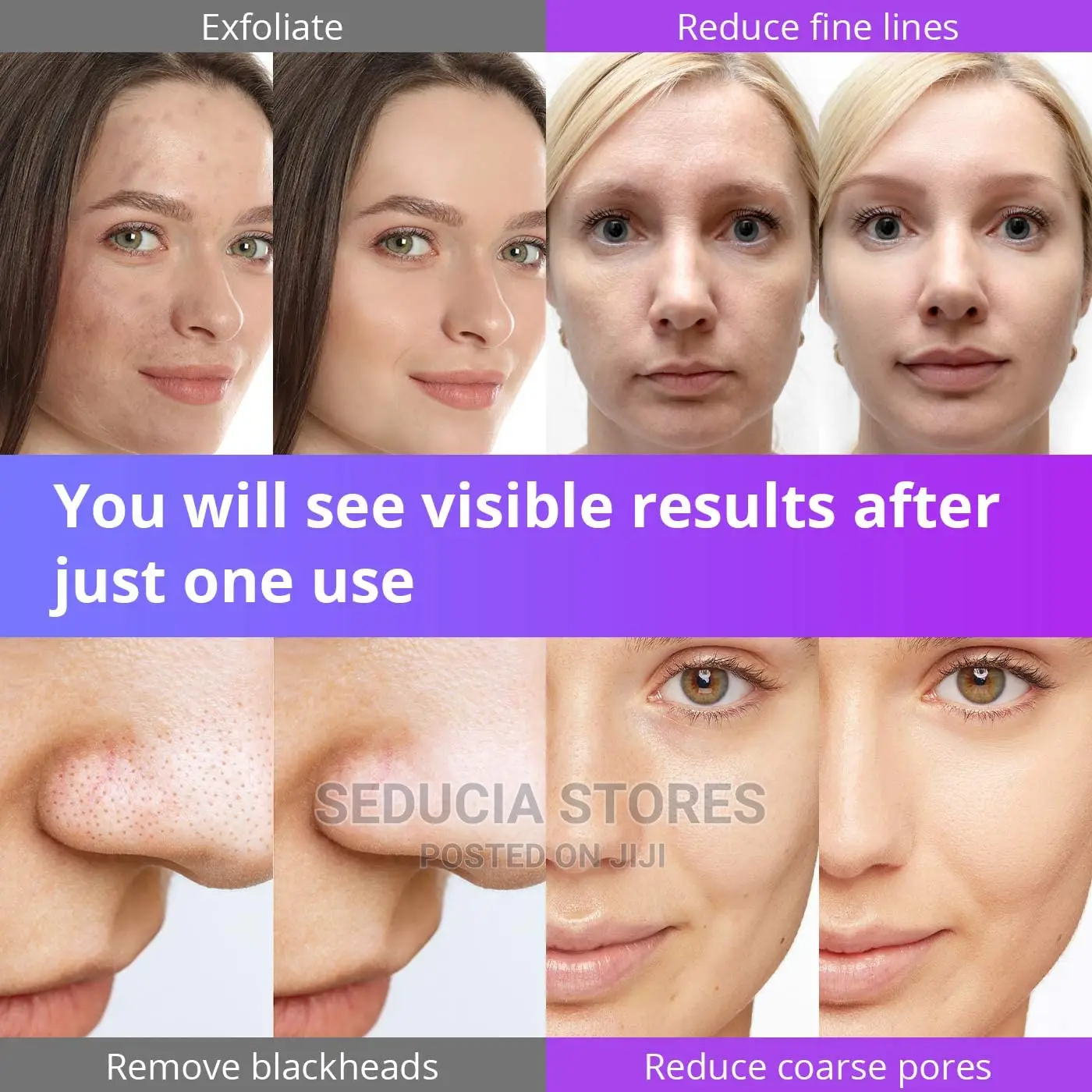 3 In 1 Diamond Peel Microdermabrasion For Facial Skin Care