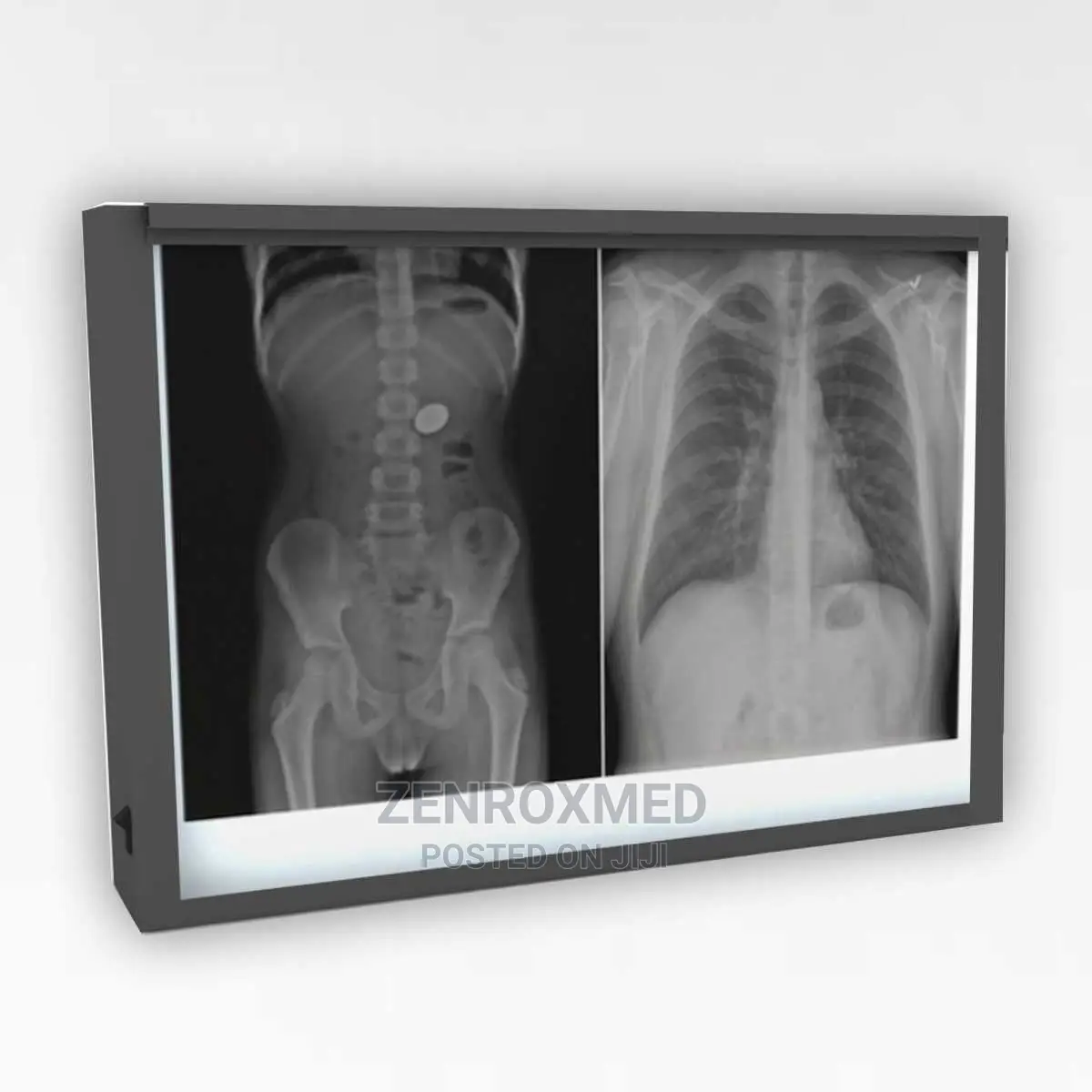 LED Double X-Ray Viewing Box
