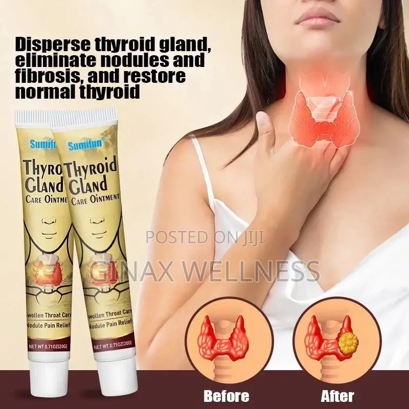 Thyroid Gland Ointment | for Goiter and Swollen Throat