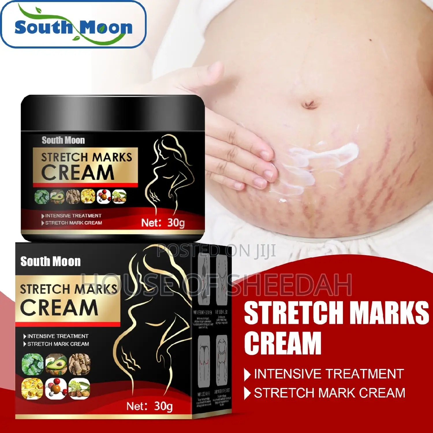 Stretch Marks Removal Cream