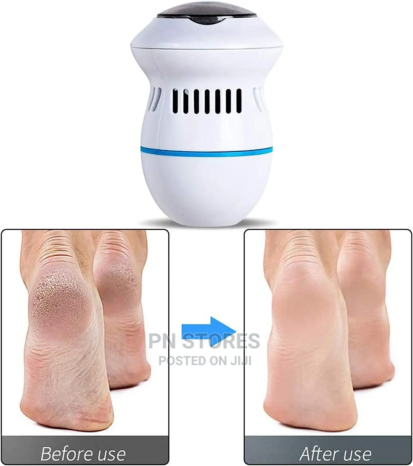 Pedi Vac Rechargeable Foot Pedicure