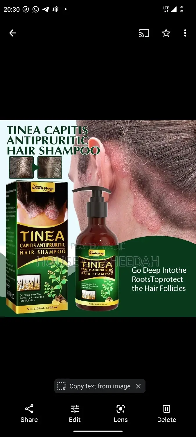 Tinea Capitis Antipruritic Shampoo