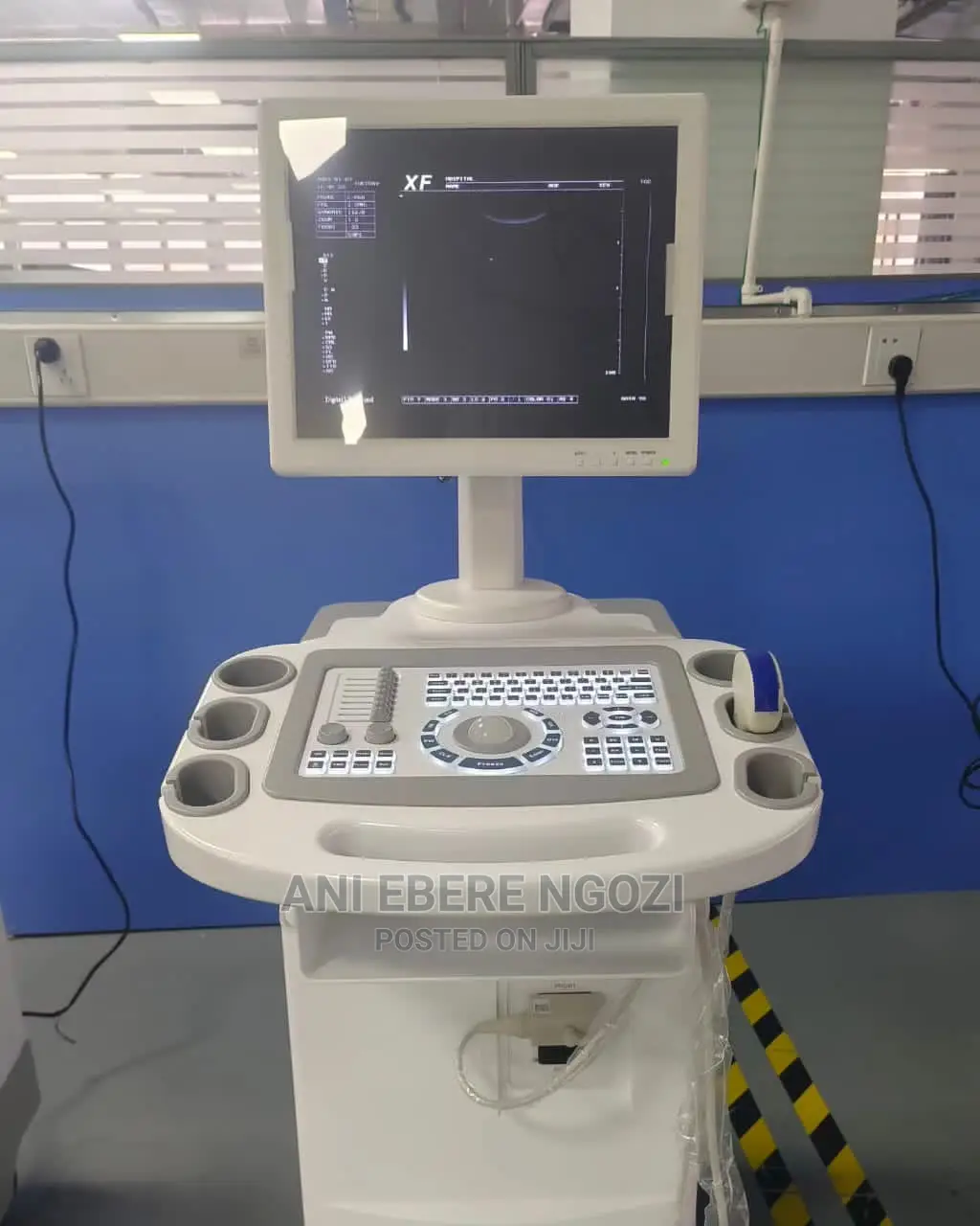 Full Digital Ultrasound Diagnostic System