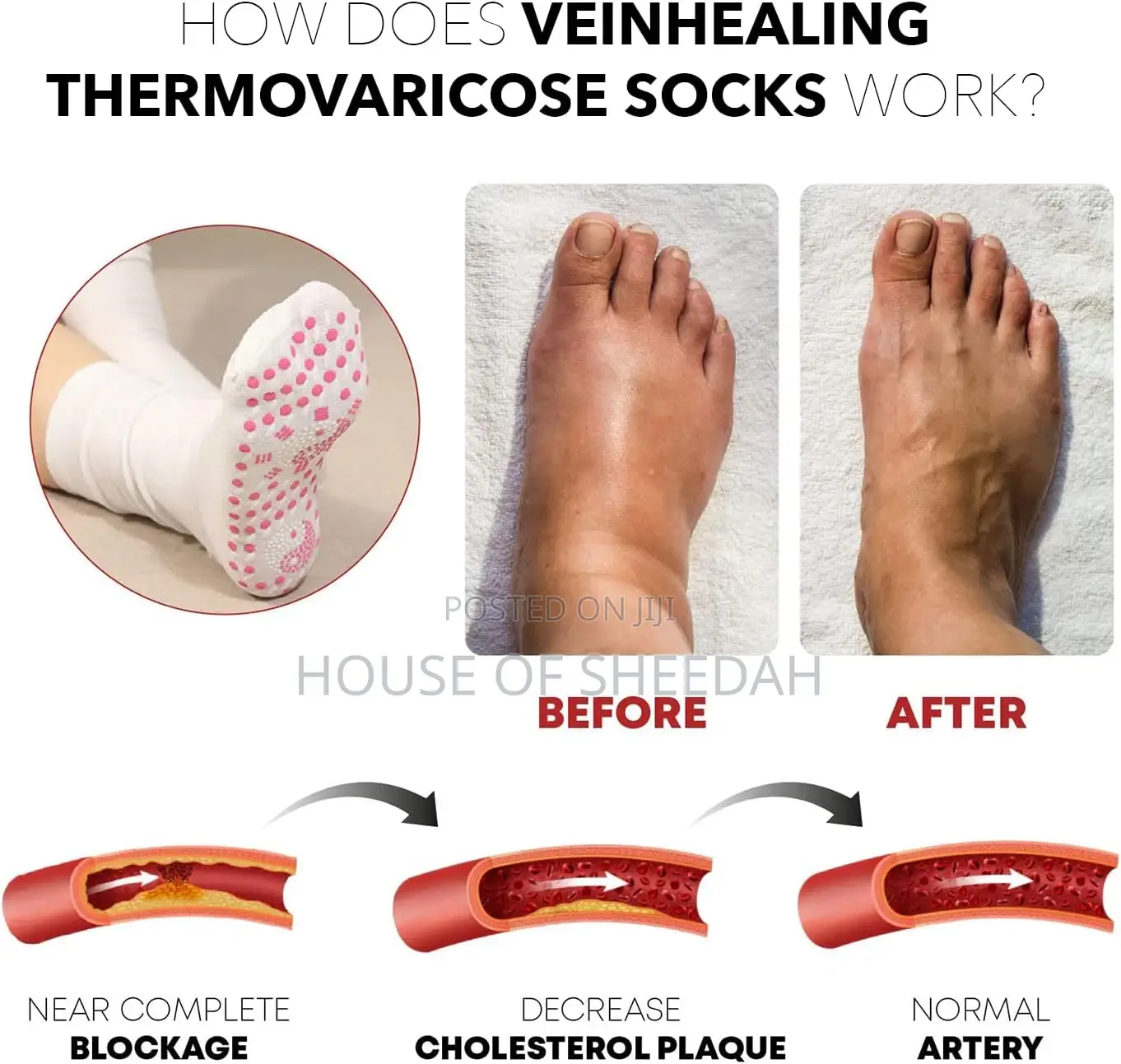 Tourmaline Slimming Health Sock -