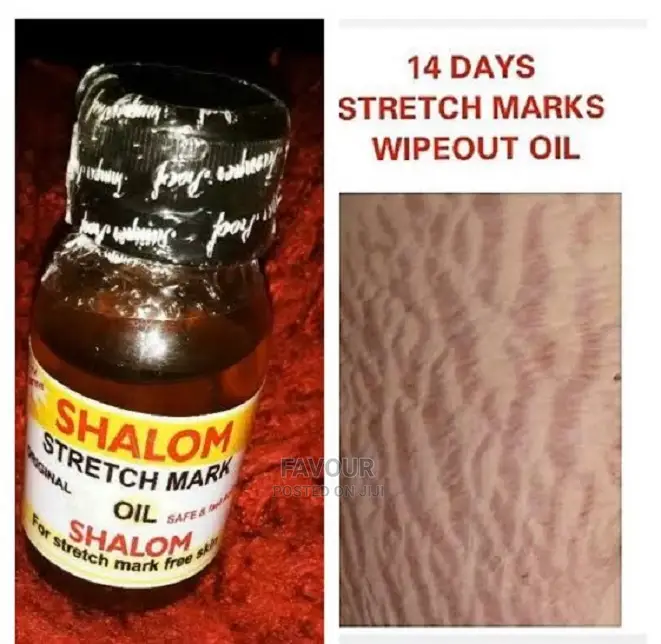 Shalom Stretch Marks Oil.