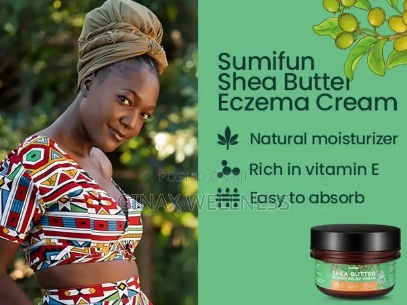 African Shea Butter Cream for Eczema,Psoriasis, and Dry Skin