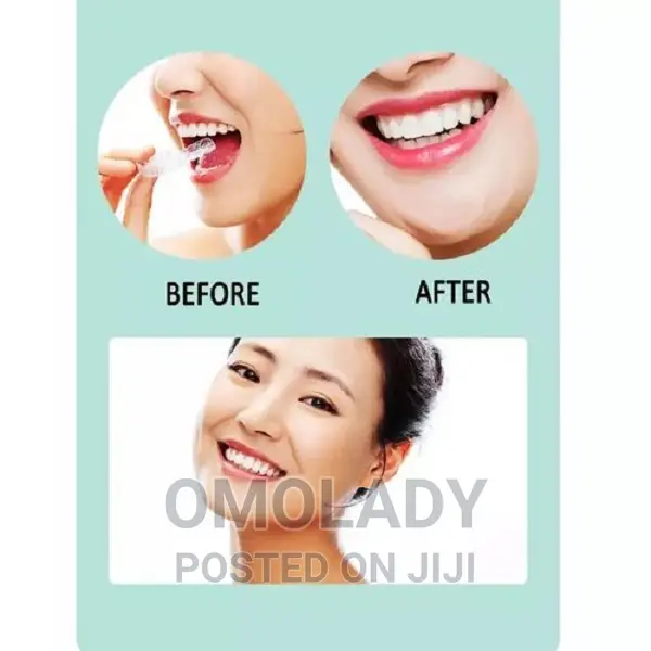Alignment Teeth Trainer - A1