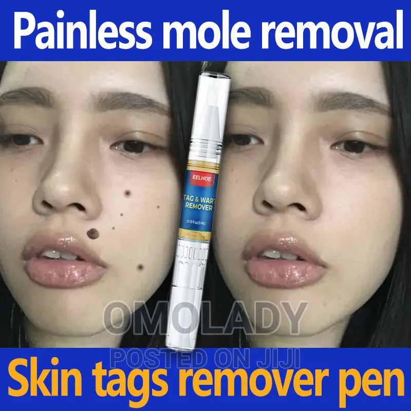 Eelhoe Tag Wart Remover - 2pc