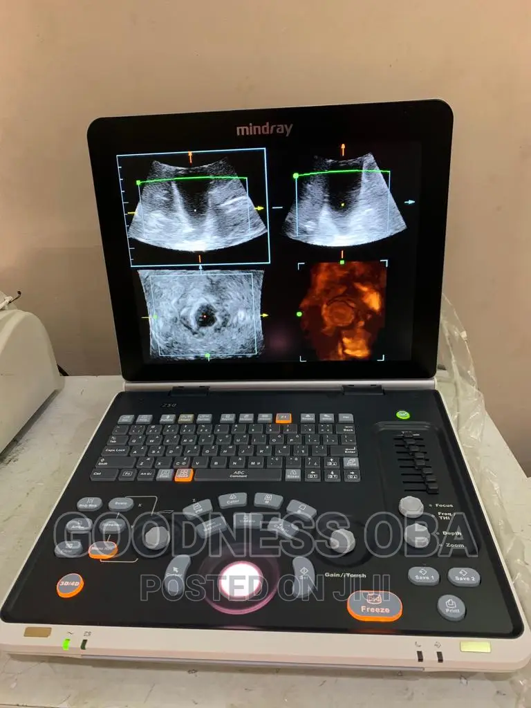 Mindray Z50 Ultrasound Machine