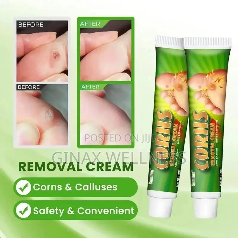 Corns Removal Cream | Topical Cream for Corns and Calluses