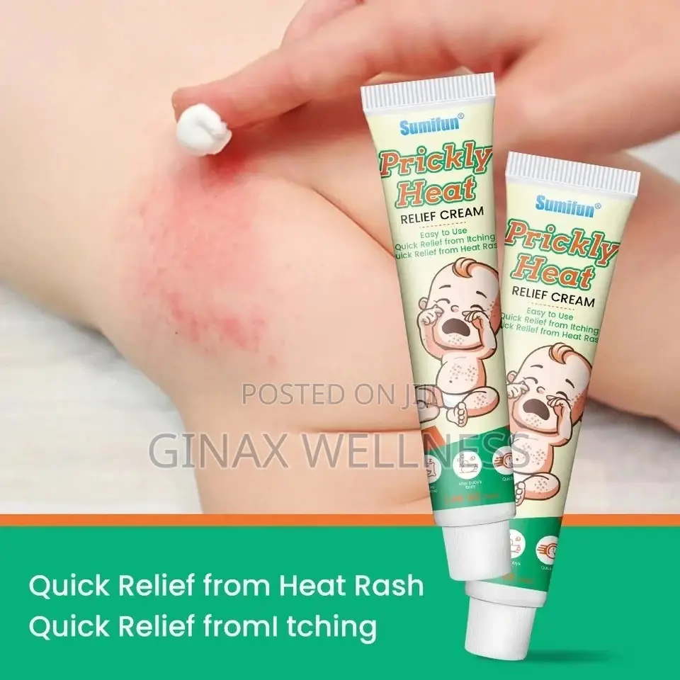 Prickly Heat Relief Cream For Babies