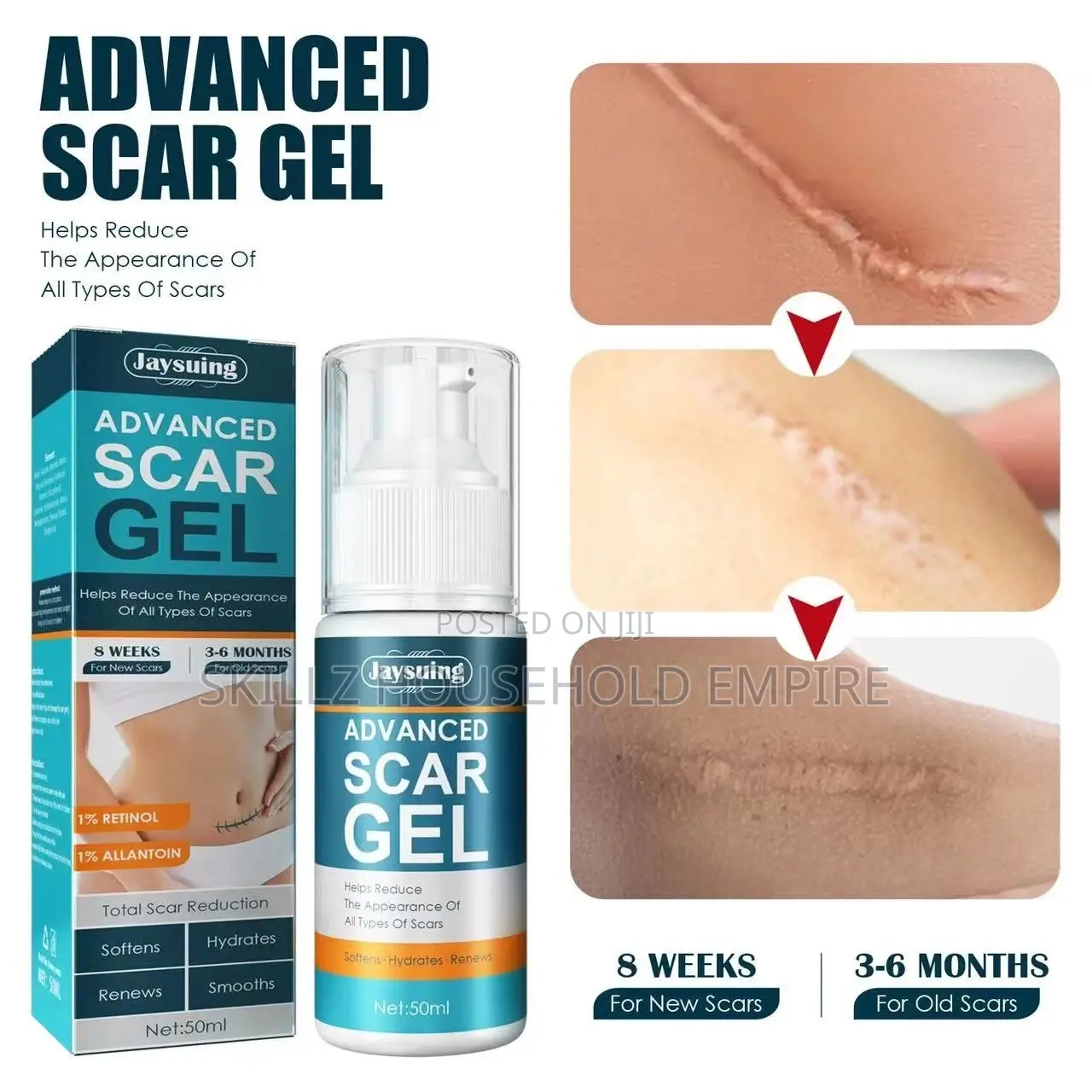 Advance Scar Gel