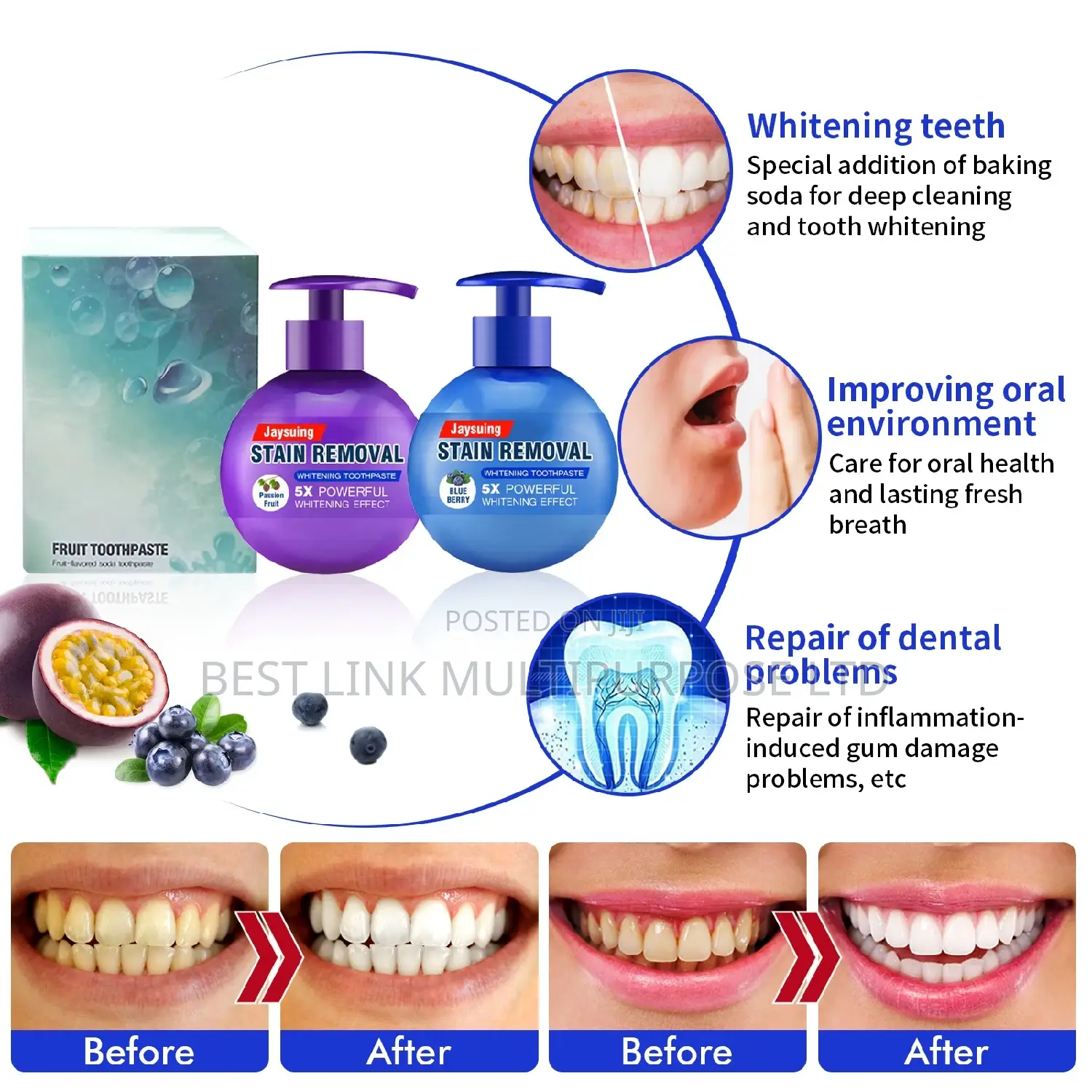 5x Powerful Stain Removal Baking Soda Toothpaste