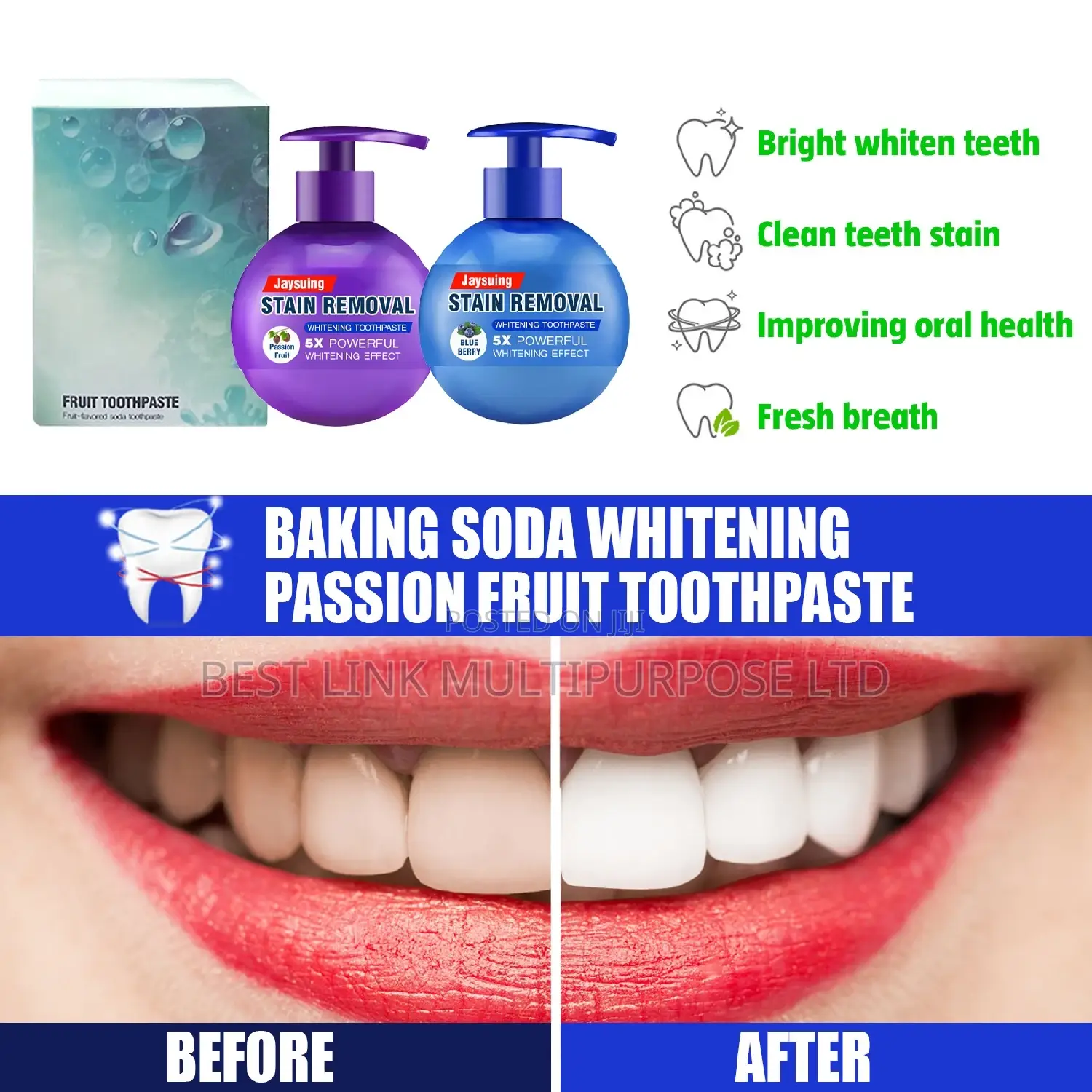5x Powerful Stain Removal Baking Soda Toothpaste