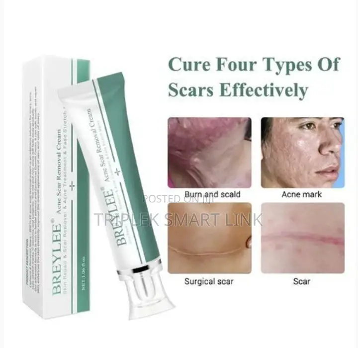 Acne Scar Removal Cream.- Skin Repair and Scar Remover