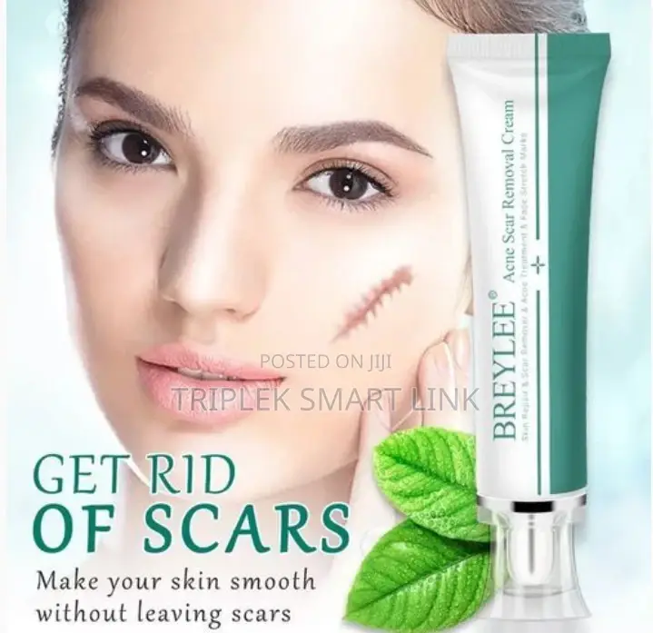 Acne Scar Removal Cream.- Skin Repair and Scar Remover
