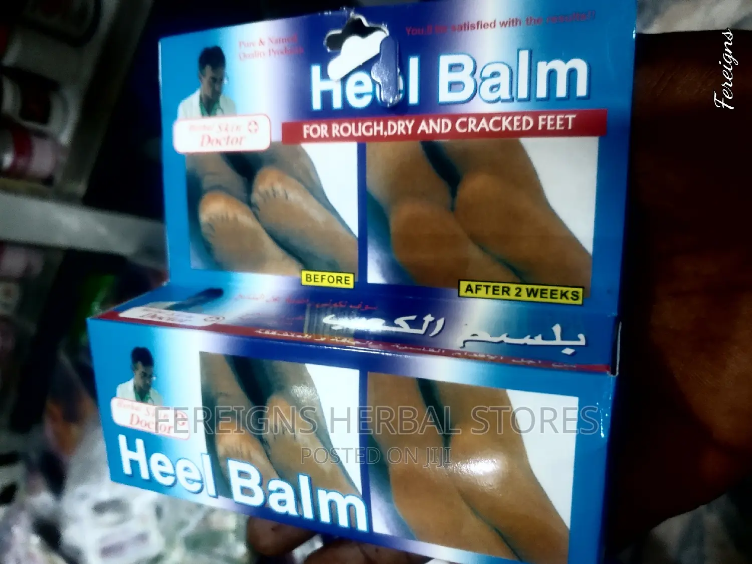 Heal Balm for Rough, Dry and Cracked Feet