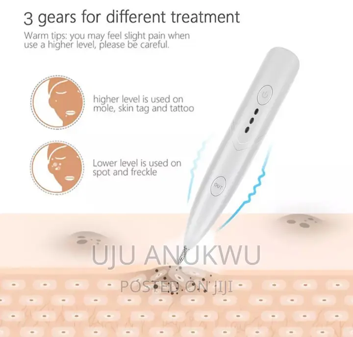 Skin Tag, Mole, Foot Corn, Wart, Scar Removal Pen