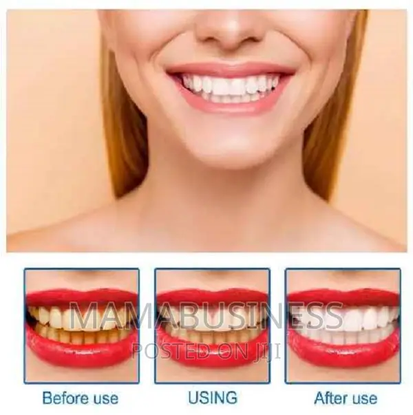 Eelhoe Teeth Whitening Essence - 10ml