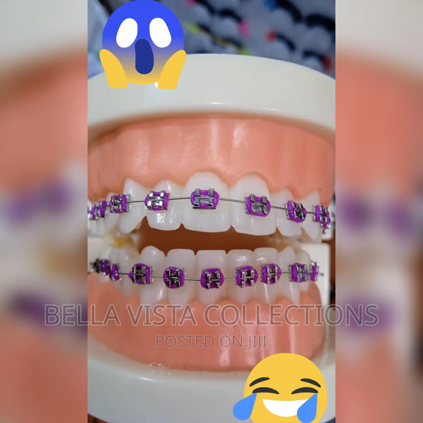 Teeth Fashion Braces
