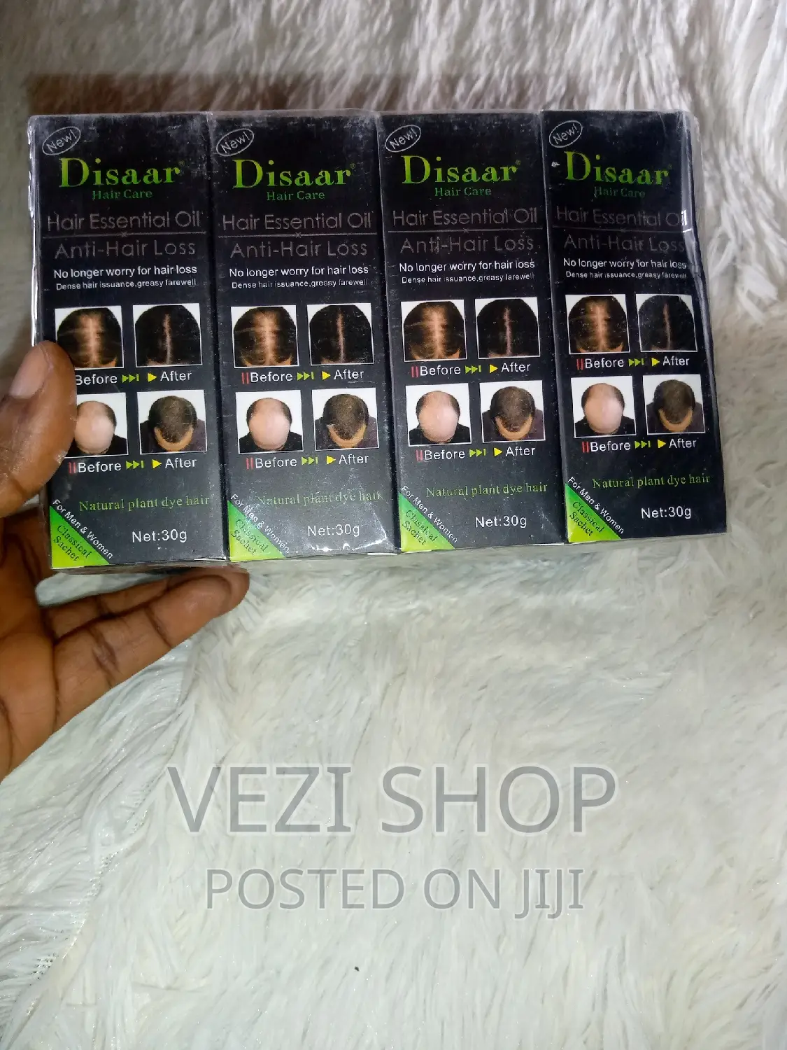 Hair Essential Oil Anti - Hair Loss