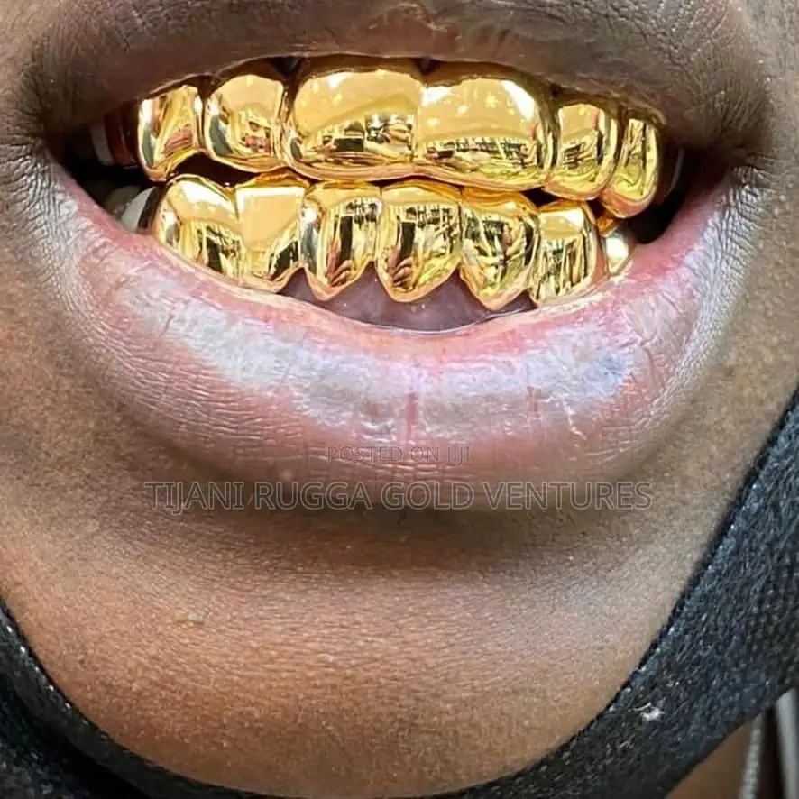 Pure 18 Karat Gold/Teeth Grills