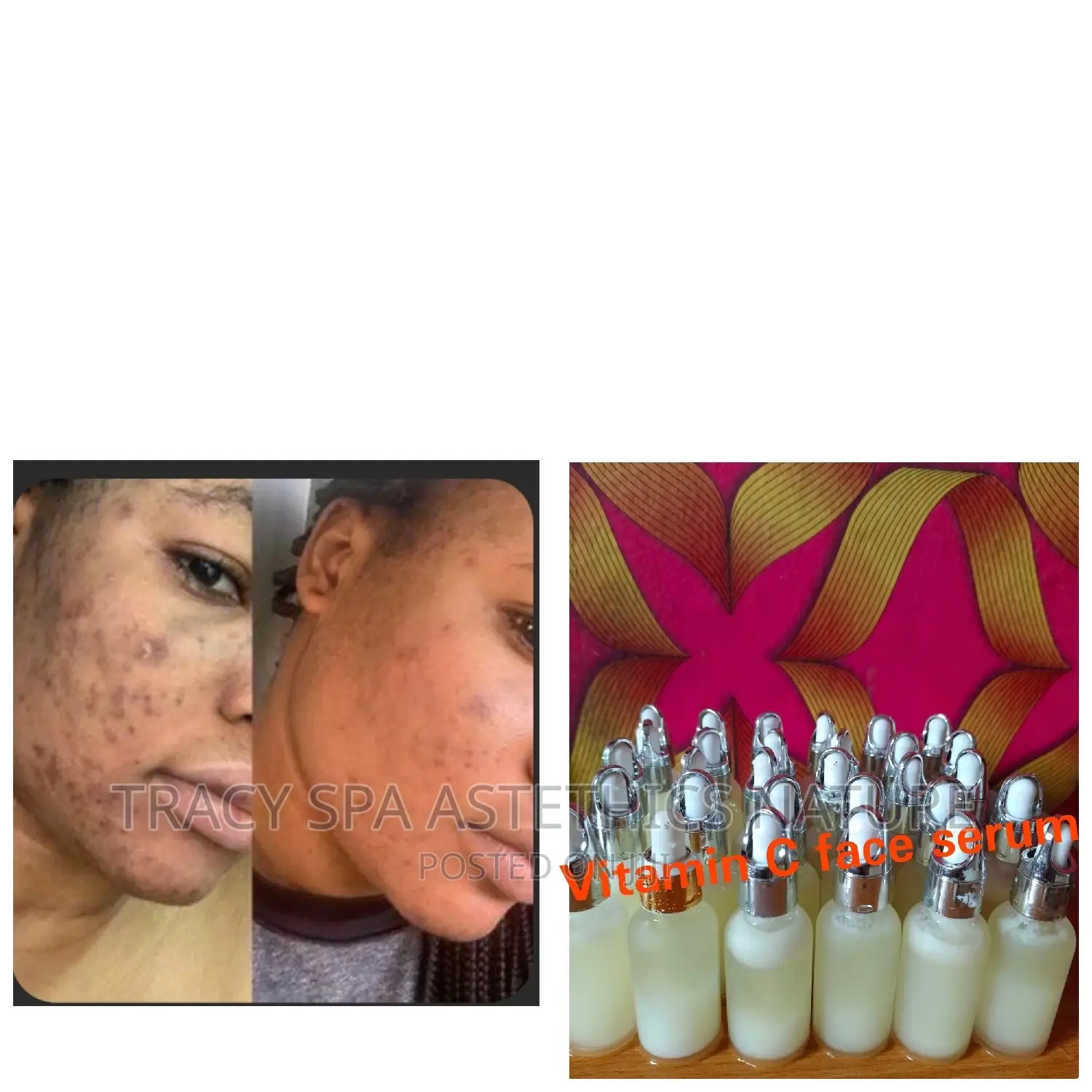 Vitamin C Brightening Face Serum
