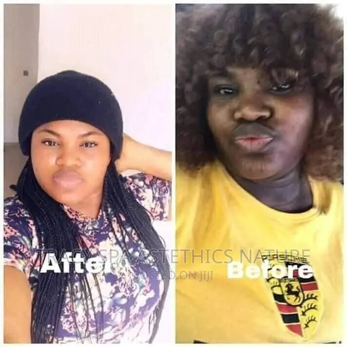 Whitening Skin Washing in Port Harcourt