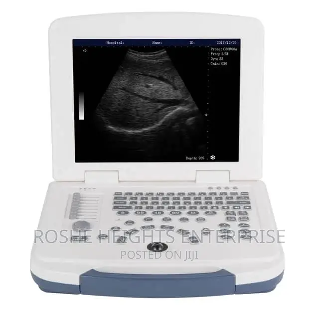 Laptop Ultrasound Machine