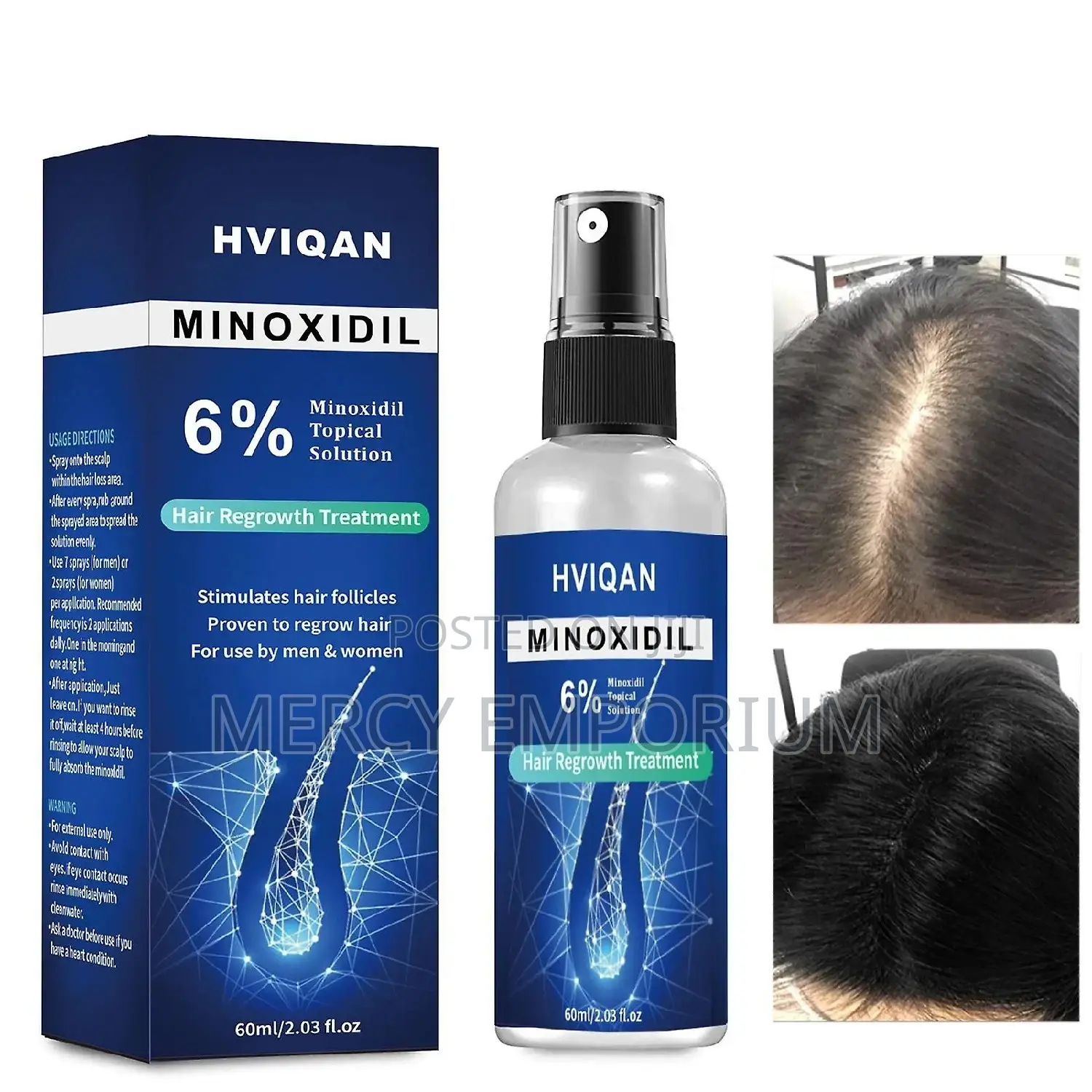 6% Minoxidil Extra Strength Beard Hair Growth Serum