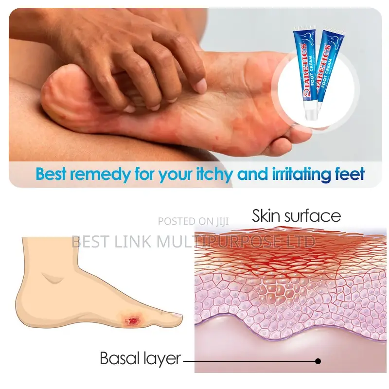 Diabetics Foot Cream