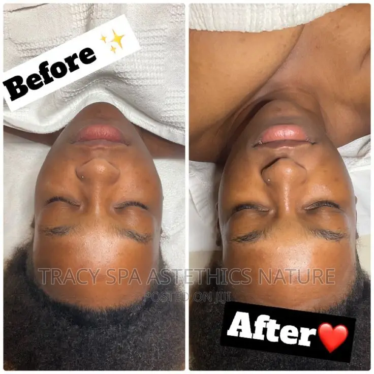 Facial Spa Treatment