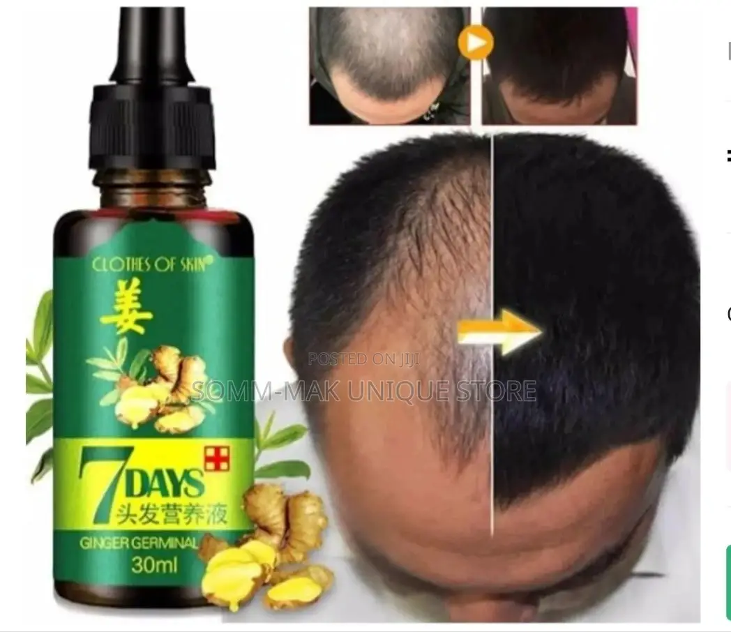 7 Days Hair Nutrient Solution Oil - 30ml