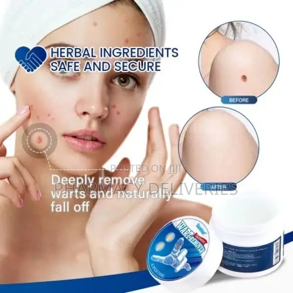 Sumifun Wart Remover Ointment -skin Tag Remover Cream
